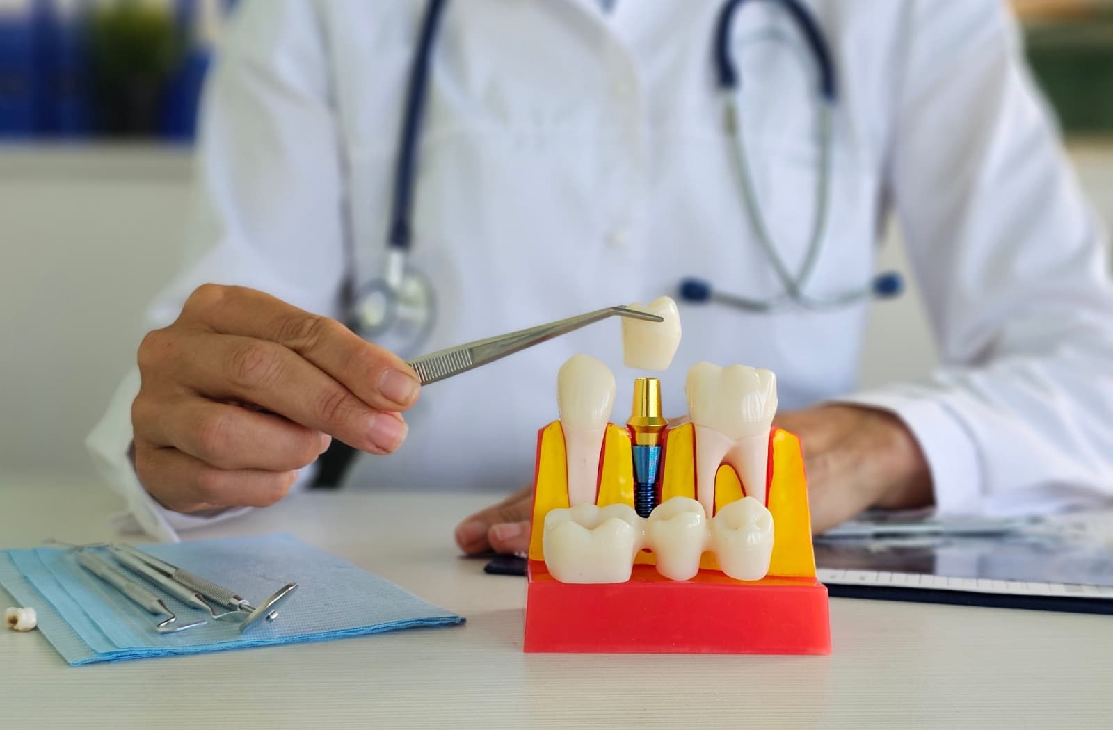 A dentist holds a dental crown over a model of a tooth with implants.